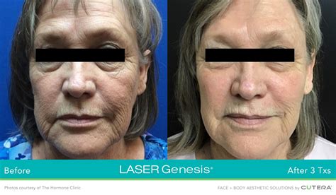 cosmetic injections glenelg|MEDICAL SERVICES .